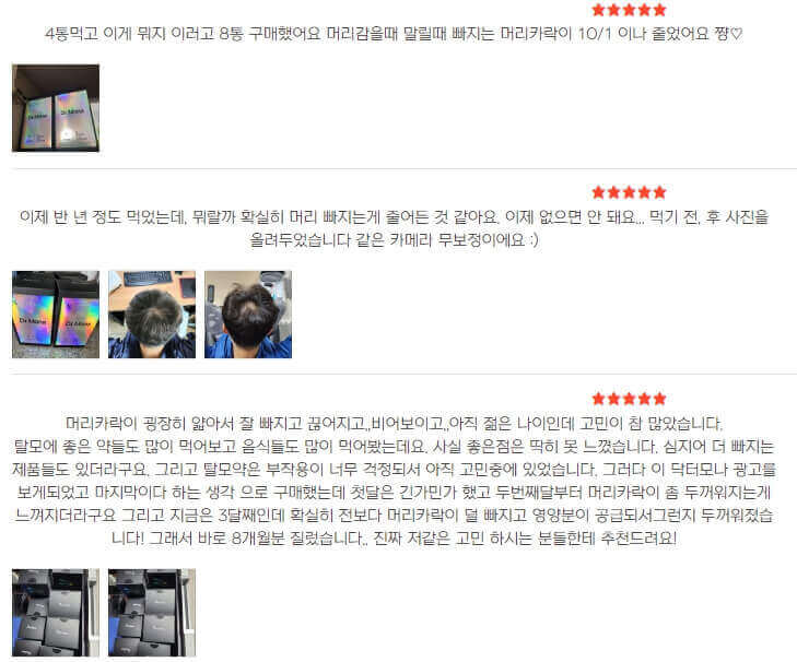 탈모약 제품 후기