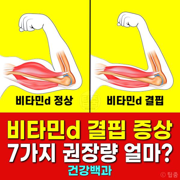 비타민d 결핍 증상 비타민d권장량
