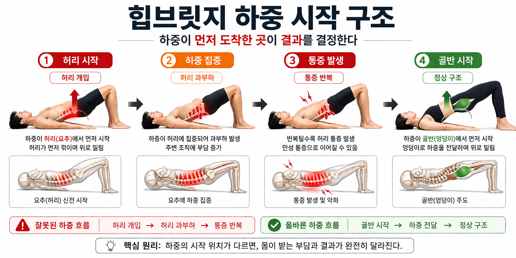 “힙브릿지 하중 시작 구조”