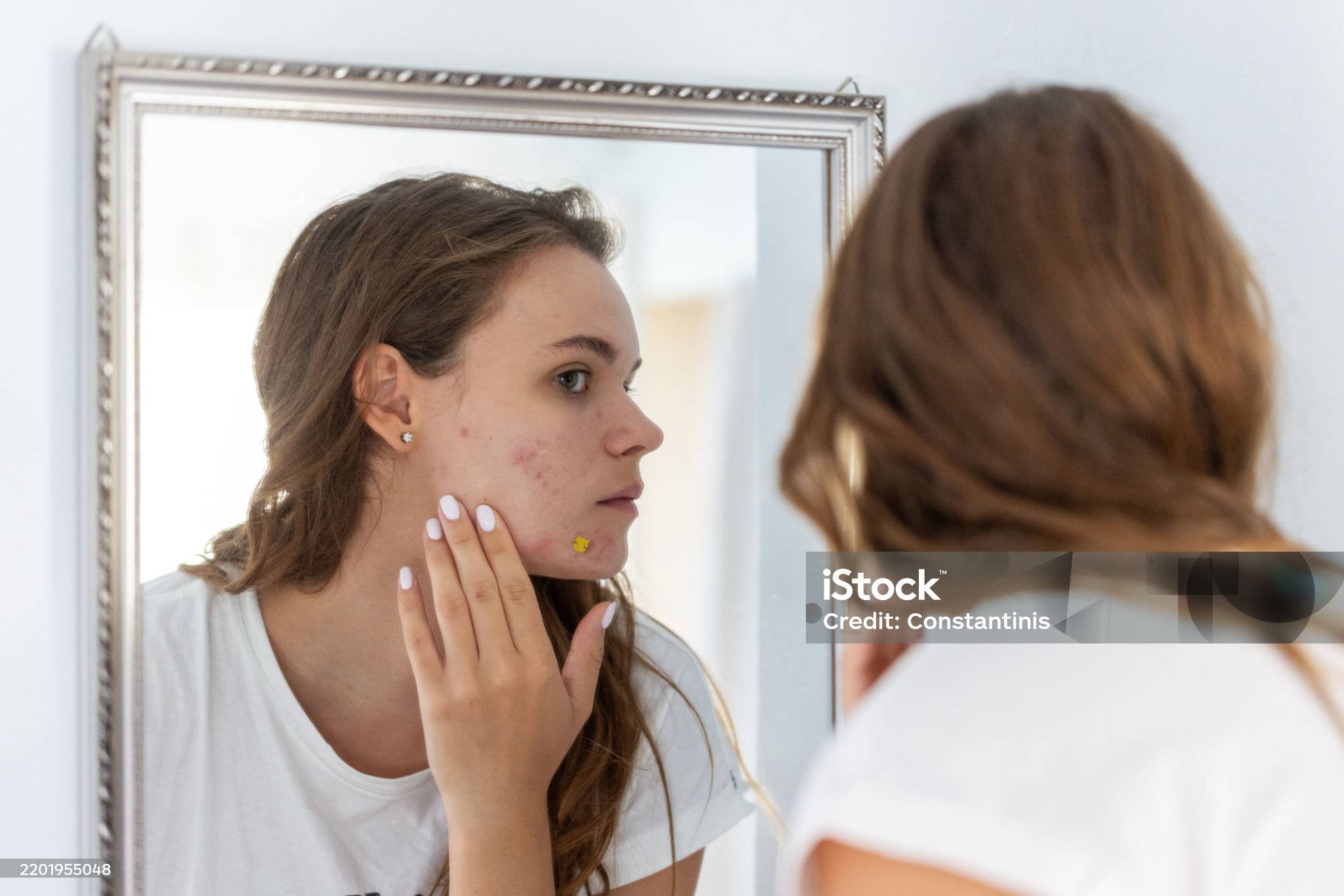 홍역 감염 초기 증상과 감기의 차이점(발진의 여부)