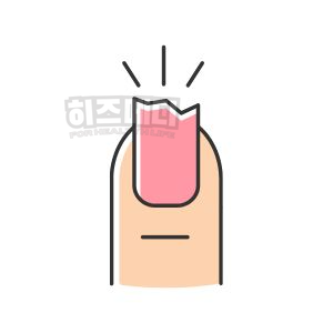 철결핍성 빈혈 원인 증상