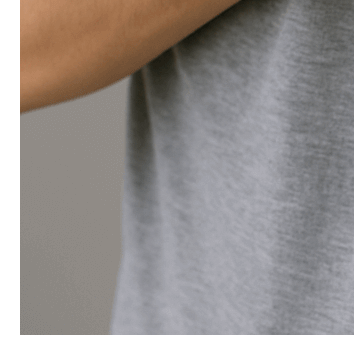 콜린성 두드러기