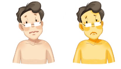 췌장암으로 인한 황달