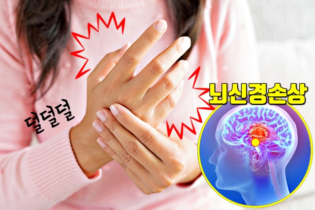 손떨림 증상 이유 원인 파킨슨병