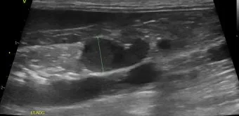 강아지 췌장암 증상 진단 치료법 안내_3