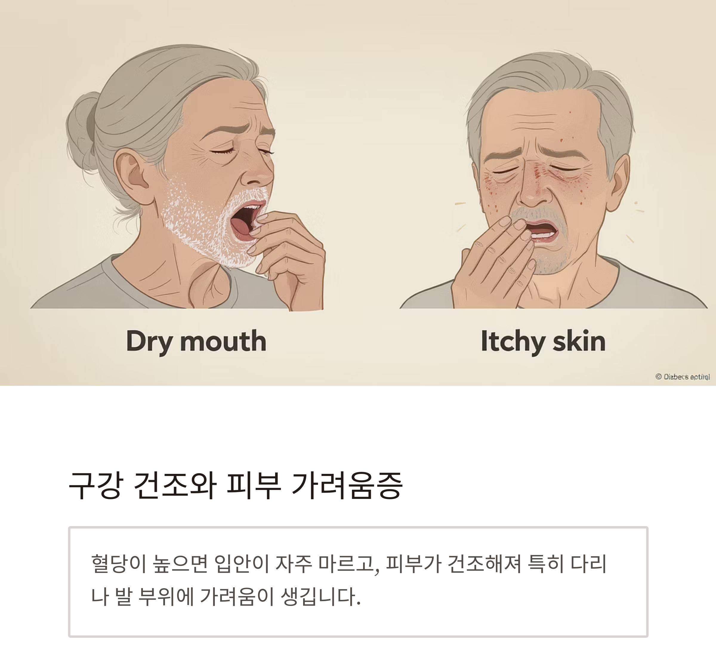 혹시 나도 당뇨? 시니어가 꼭 알아야 할 당뇨병 초기 증상