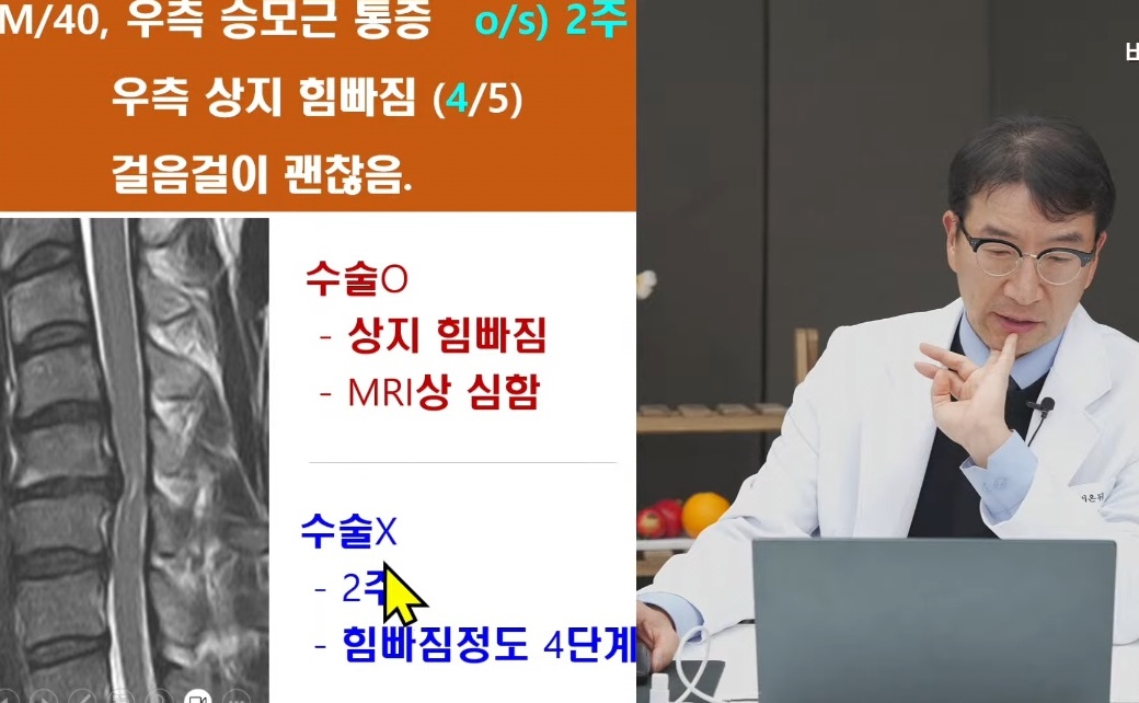 EBS-명의-목중풍-강경중-교수
