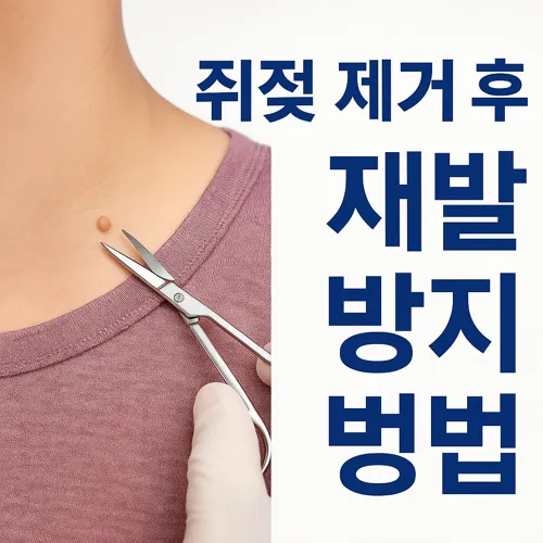 쥐젖 제거 후 재발 방지 방법 썸네일