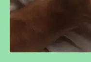 땀띠 원인과 증상 &amp; 치료