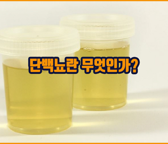 단백뇨란 무엇인가