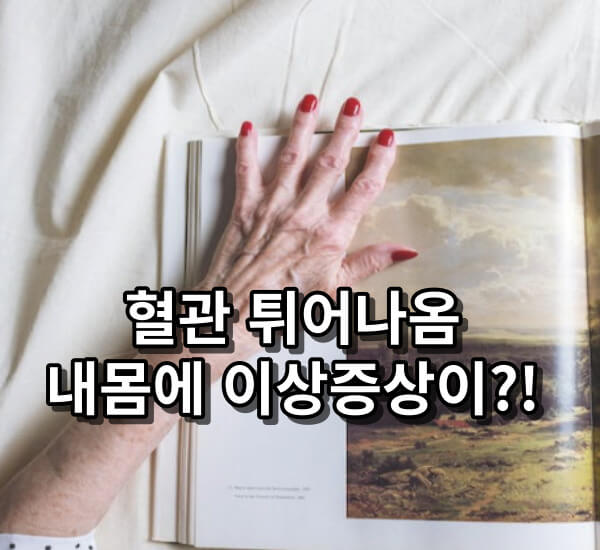 혈관 튀어나옴 증상 원인과 대처법