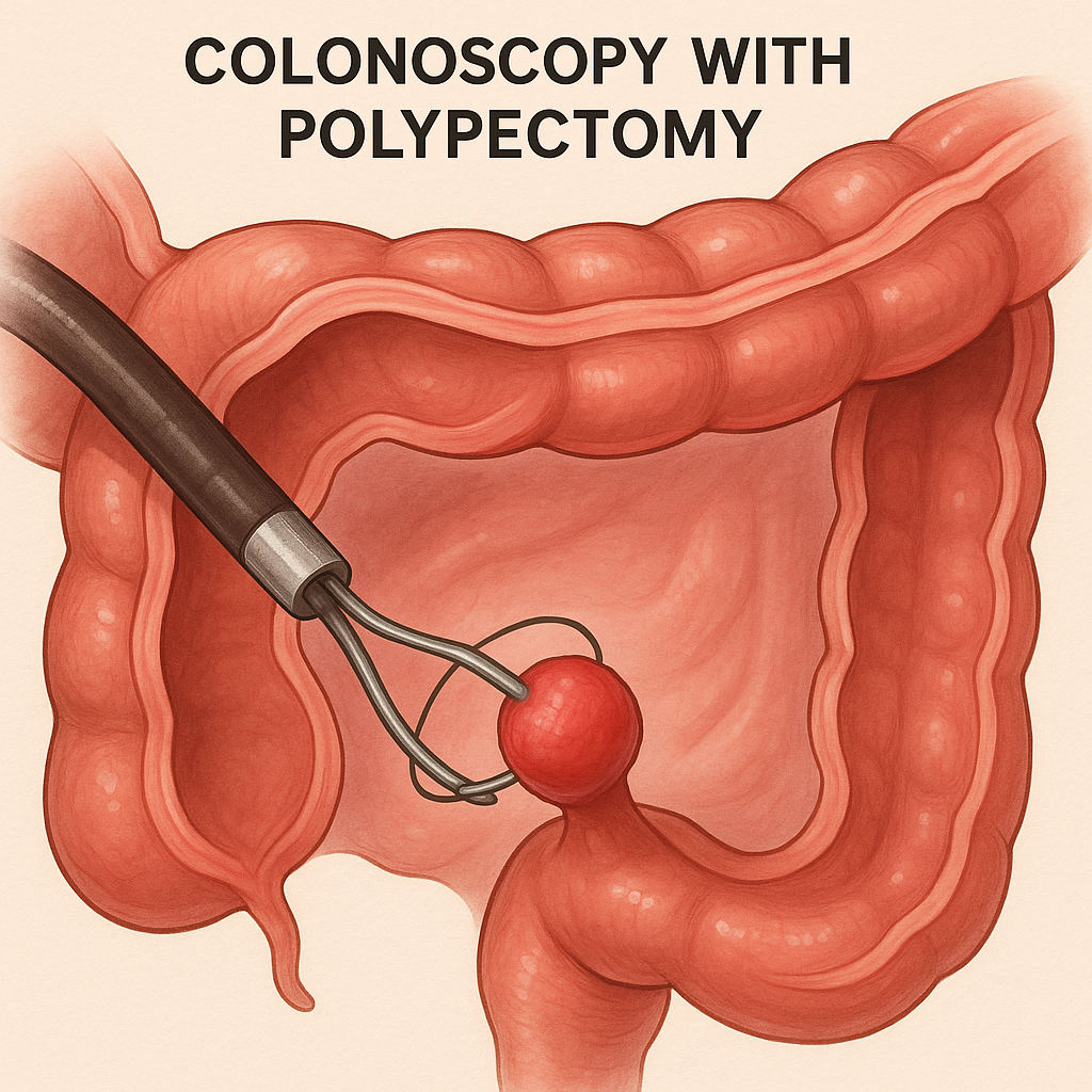 대장내시경 용종 제거 후 조직검사 결과가 관융모선종이라면 괜찮은 걸까?