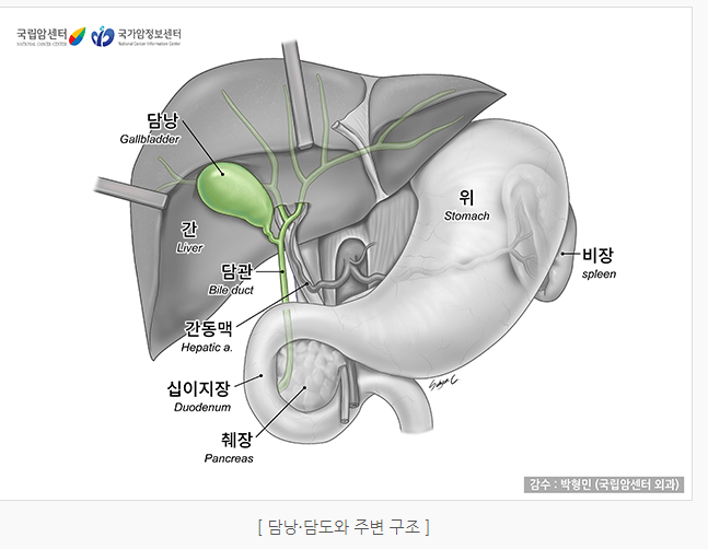 담낭암 담도암의 원인과 암 발생률