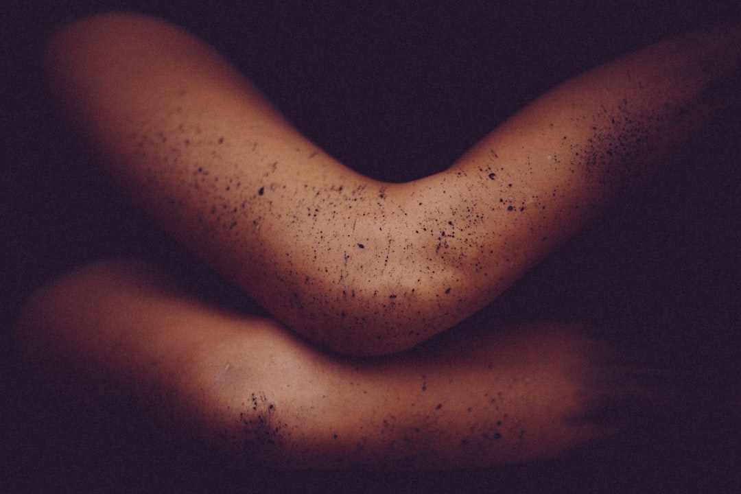 Swelling