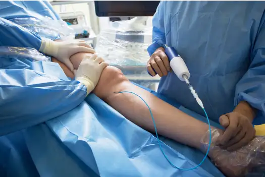 하지정맥류 초기 증상과 원인 치료방법