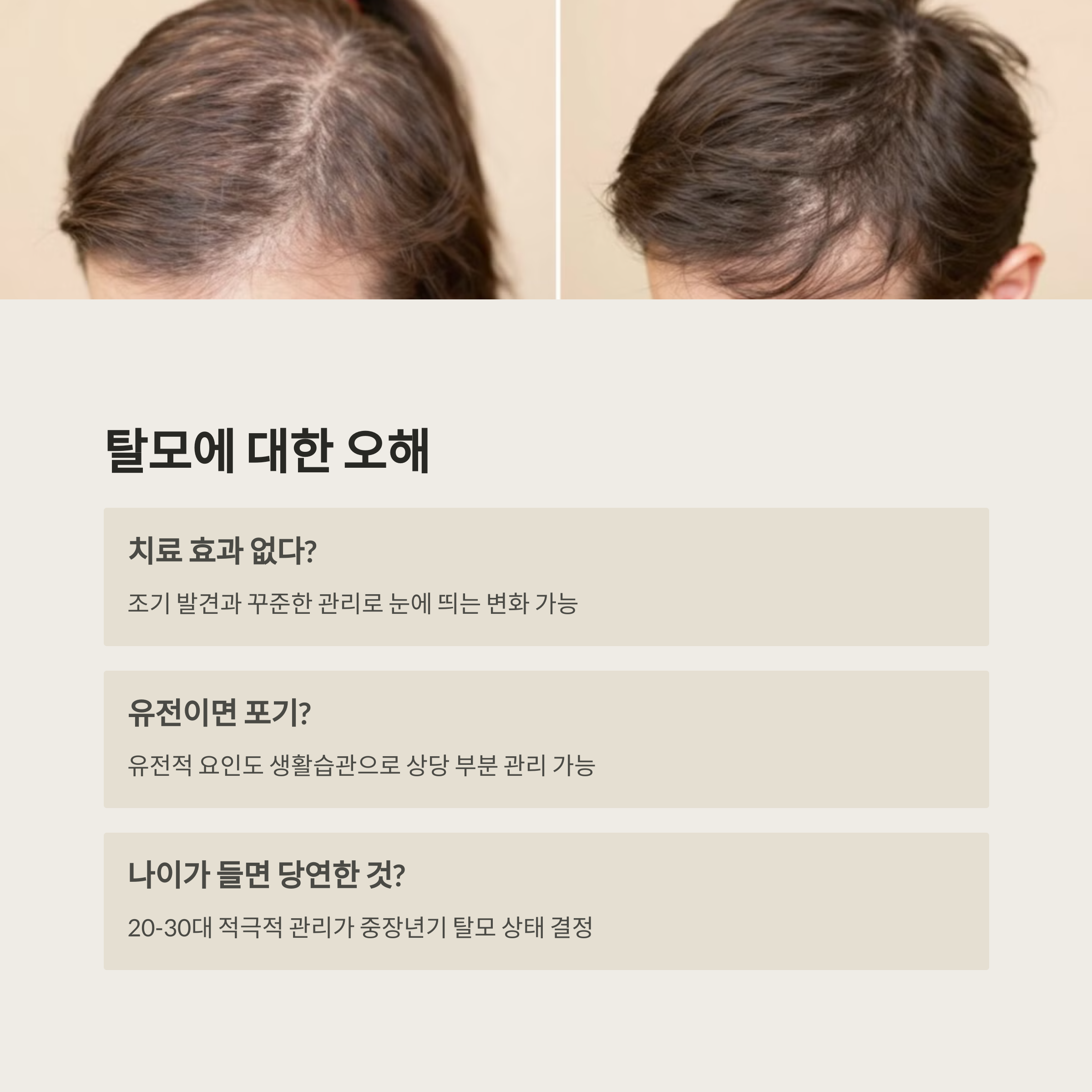 탈모 비교 이미지