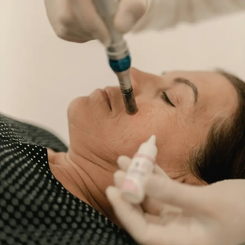 피부노화로 생긴 기미&middot;잡티&amp;#44; 시술 전 이것부터 확인하세요 (1)