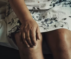 퇴행성 관절염 치료제 예방법 진단기준