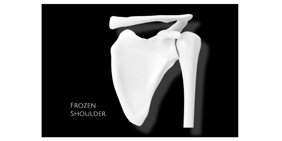 오십견 원인과 증상
