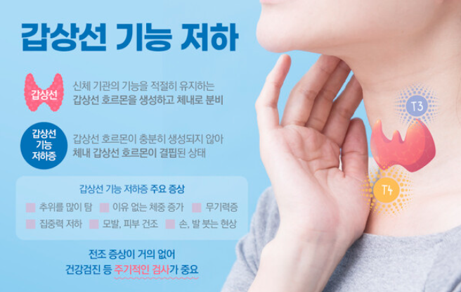 갑상선 기능 저하증 개요