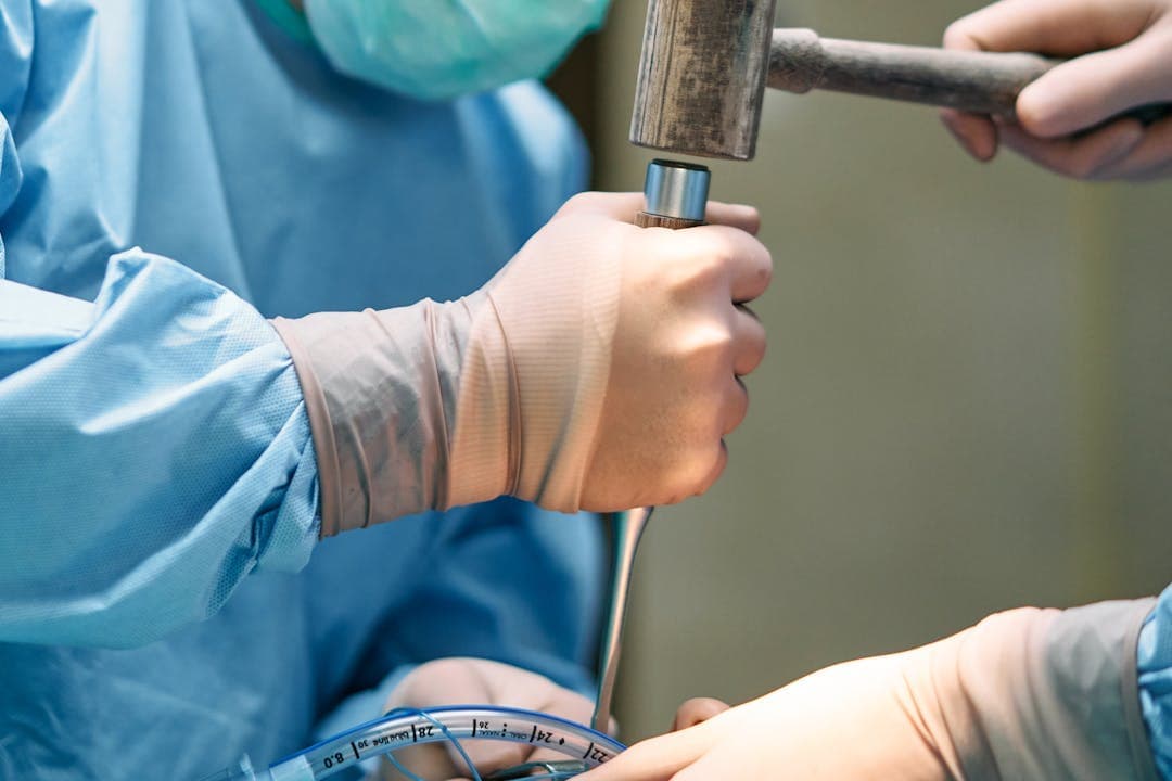 임플란트 수술 중 골이식 혹은 드릴 삽입 장면 근접촬영