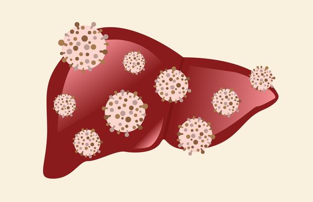 A형간염 치료법