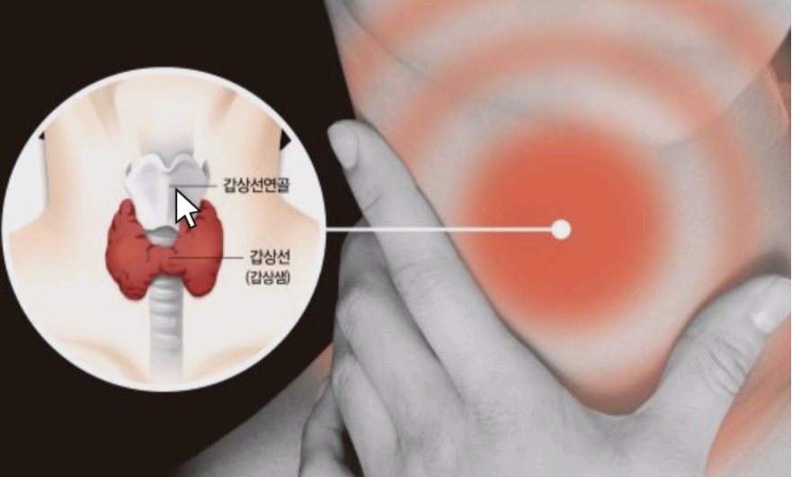 목이부어있는