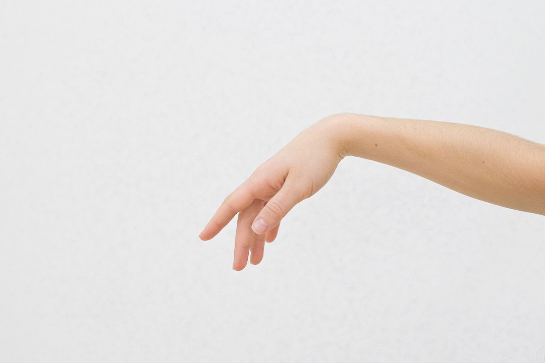 Arm