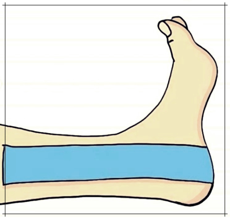 발목 테이핑 방법 : 집에서 쉽게 따라하기