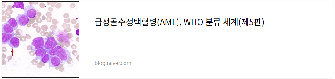 급성골수성백혈병 원인, 증상, 진단, 치료방법