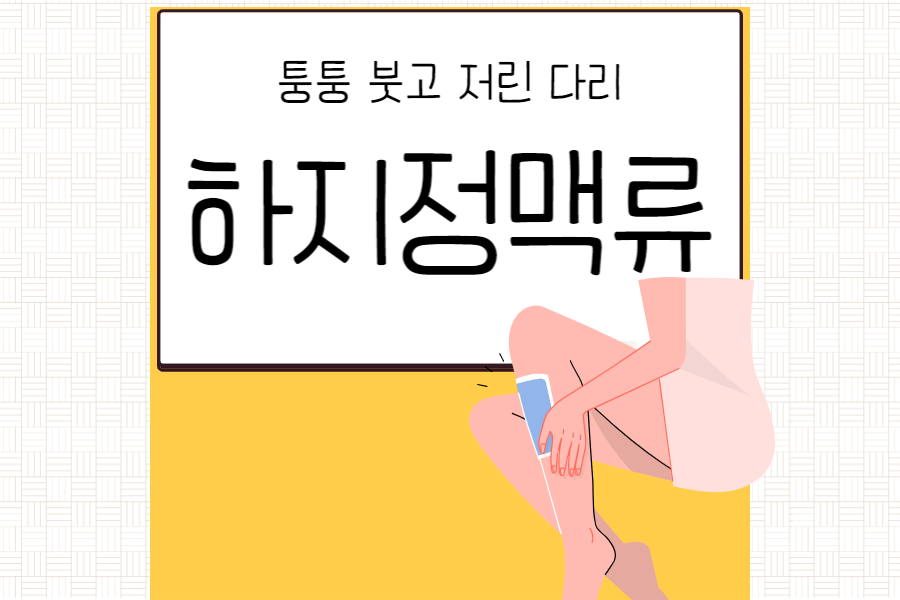 섬네일