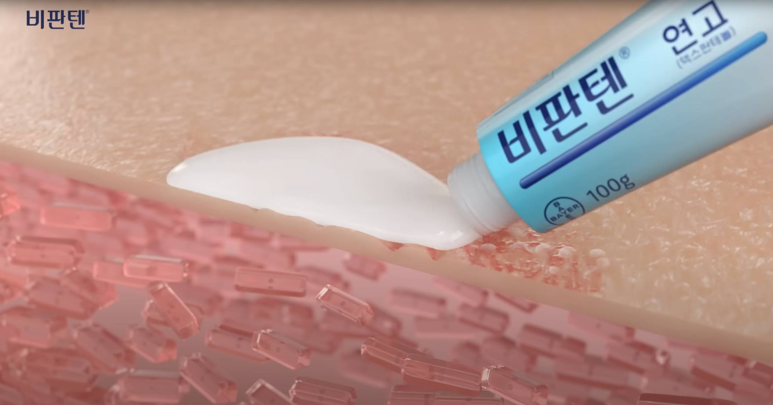 땀띠 연고