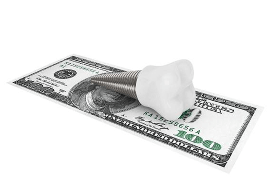 임플란트 보험적용