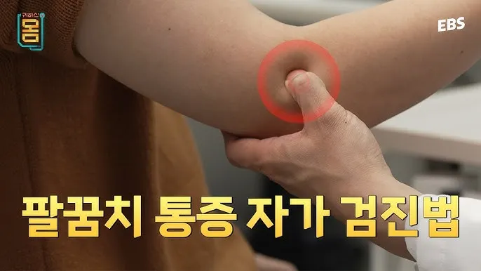 팔꿈치 통증 원인 6가지증상운동법예방법치료법까지_7