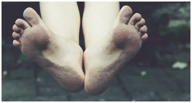 족저 근막염 신발 깔창 추천 및 선택 가이드