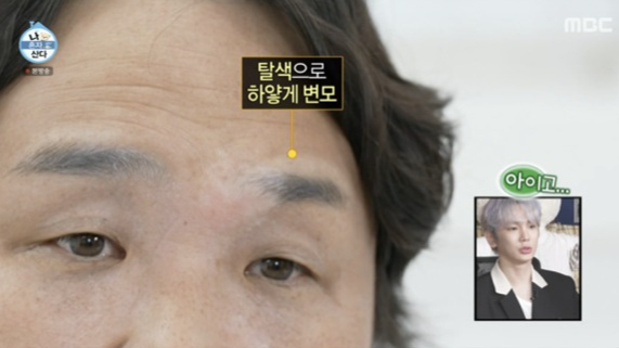 ‘나 혼자 산다’ 구성환의 백반증 투병 이야기