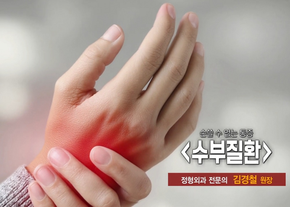 EBS명의-손목-명의-이재성-교수-수부세부-정형외과