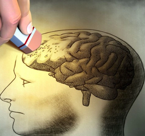 치매 초기증상 8가지 및 치매 예방 검사 총정리