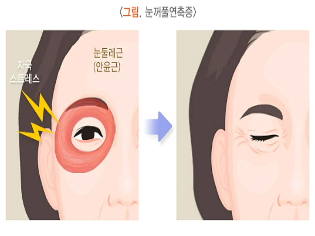 눈밑이 떨리는 증상