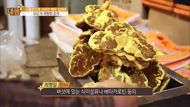 뇌졸중-김희라