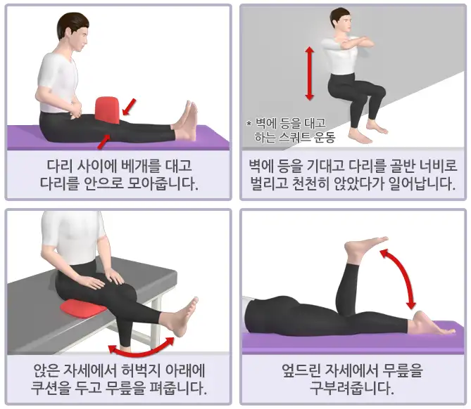 무릎관절염-하체운동중단-이미지