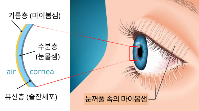 안구건조, 마이봄샘