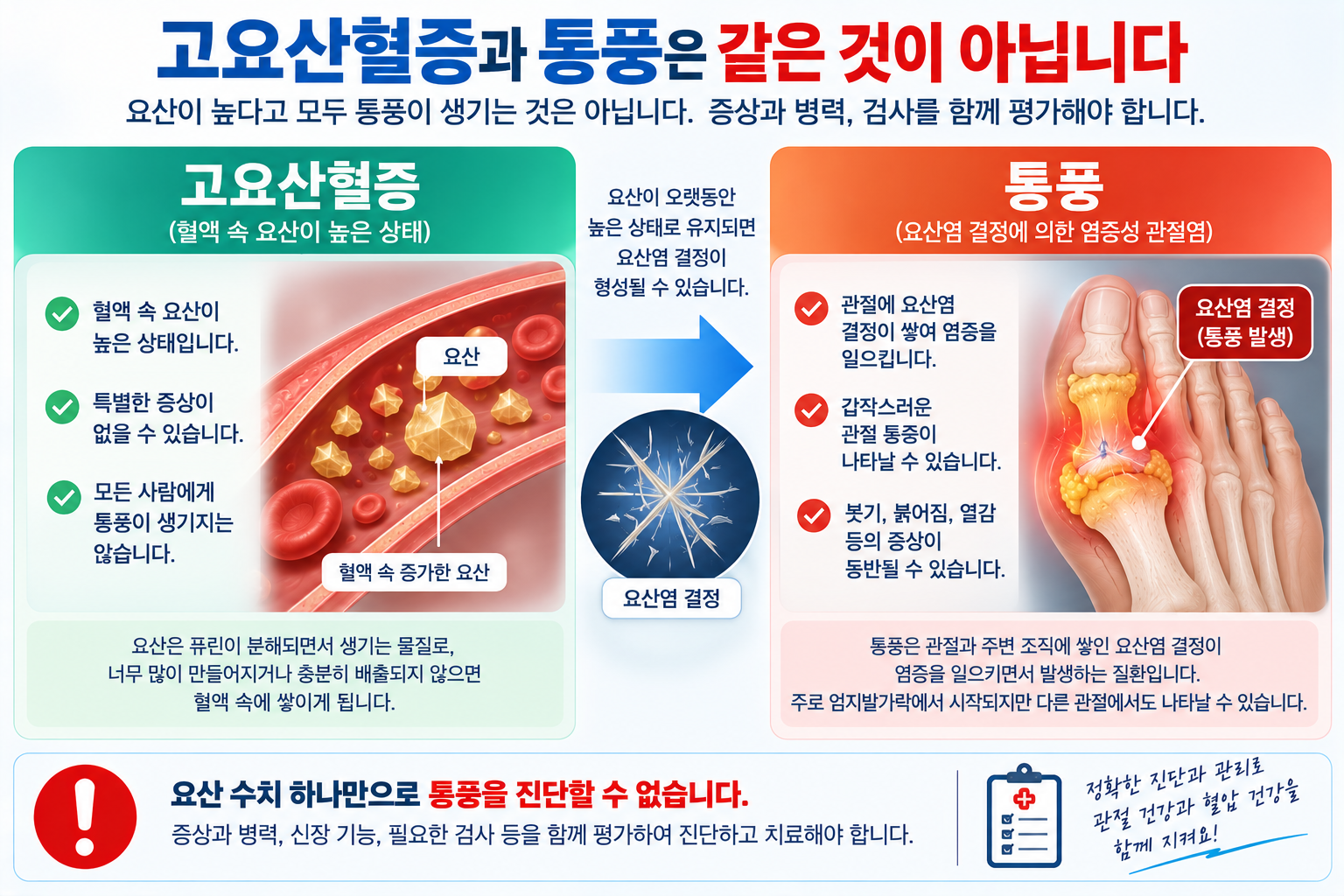 고요산혈증과 요산염 결정에 의한 통풍의 차이를 설명하는 개념도