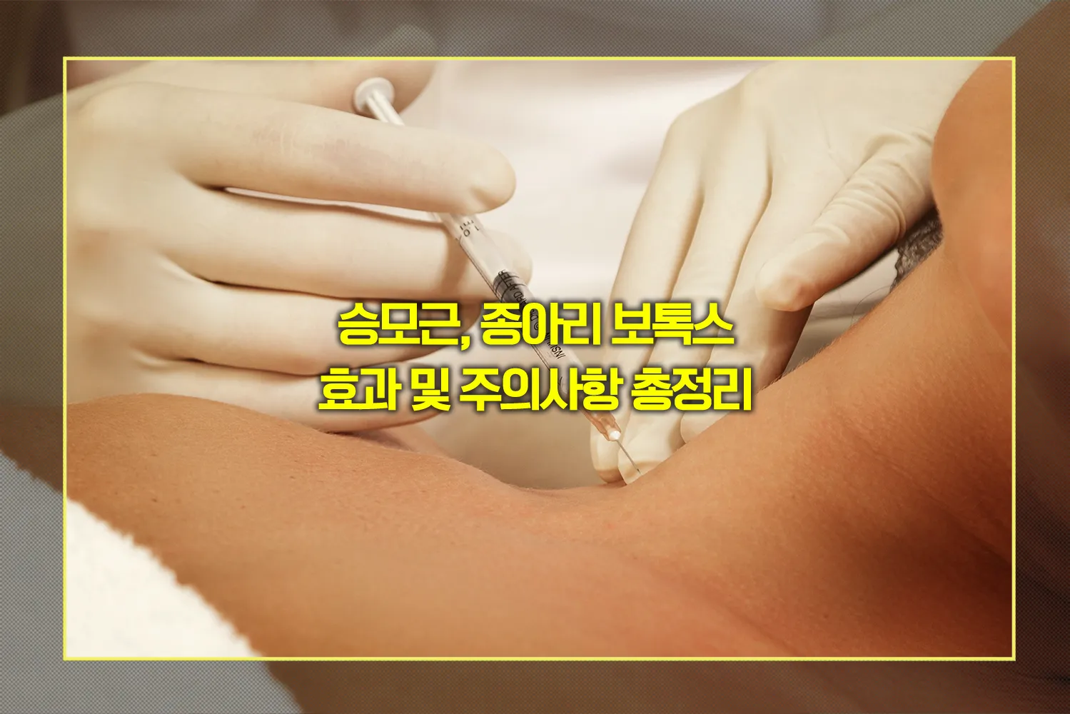 승모근-종아리-보톡스-효과-지속기간