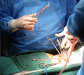 역류성 식도염 진단 기준 합병증 관리