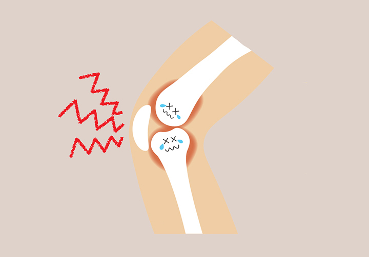 인대-및-뼈-조직-강화