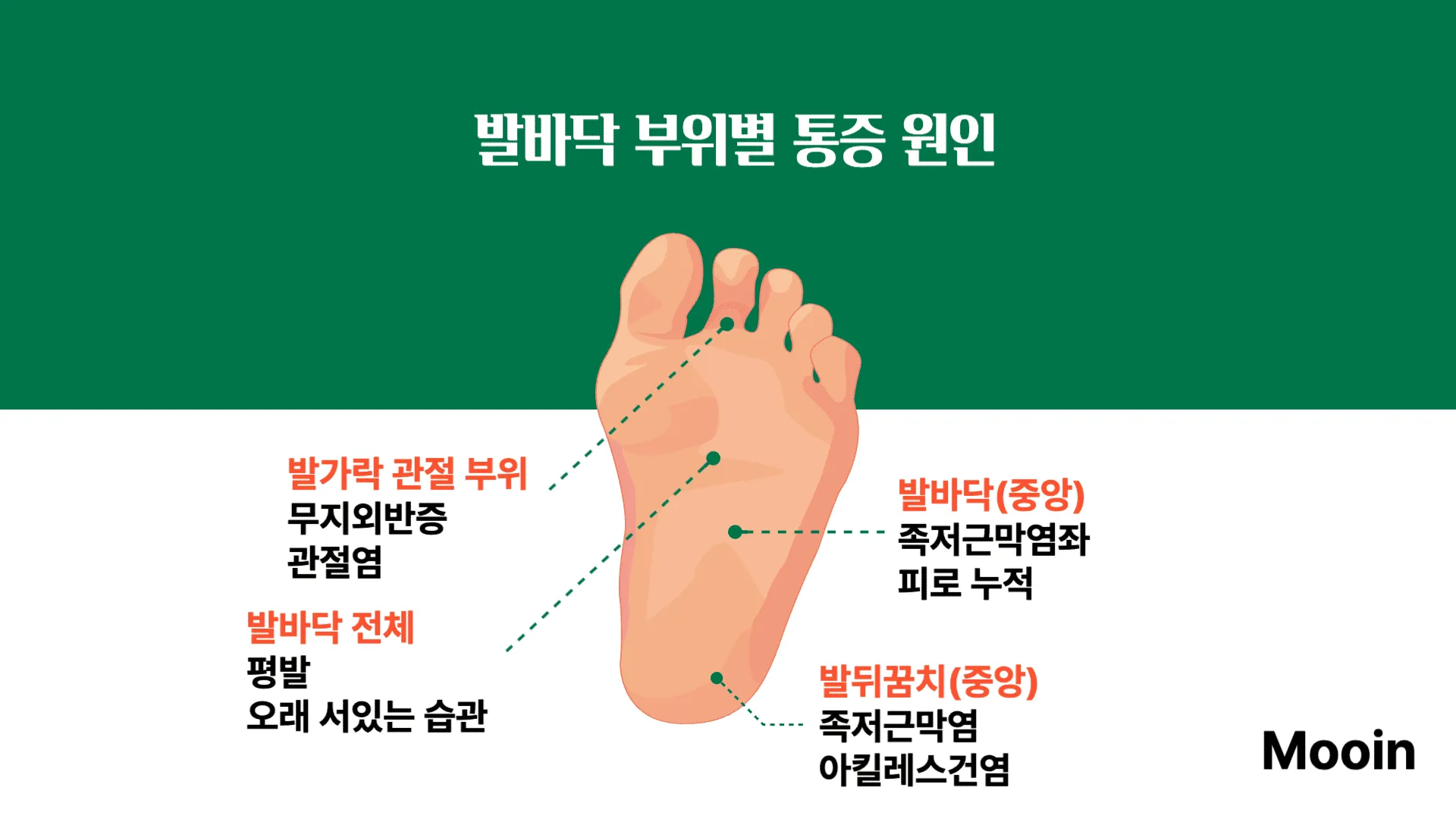 발바닥 부위별 통증, 이유는 무엇인가요?