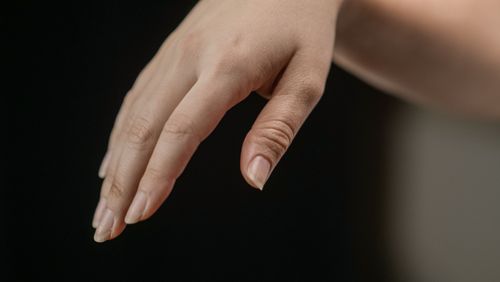 여름철 손 붓는 이유 7가지&amp;#44; 반지가 꽉 낀다면 꼭 확인하세요