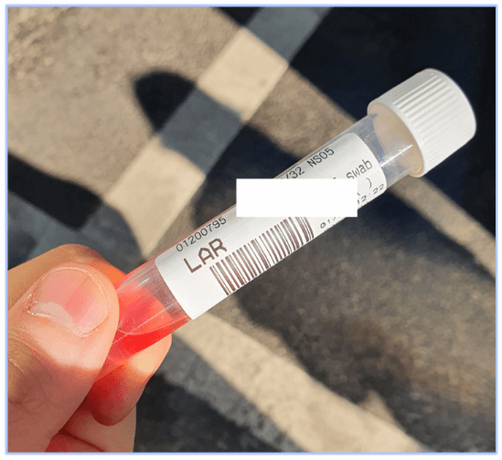 검체-채취-용기