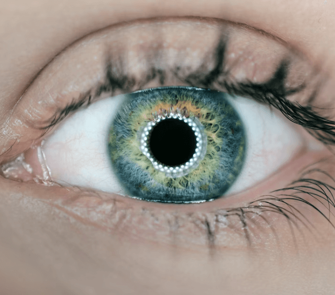 밀토제놀 효능 - 녹내장 예방